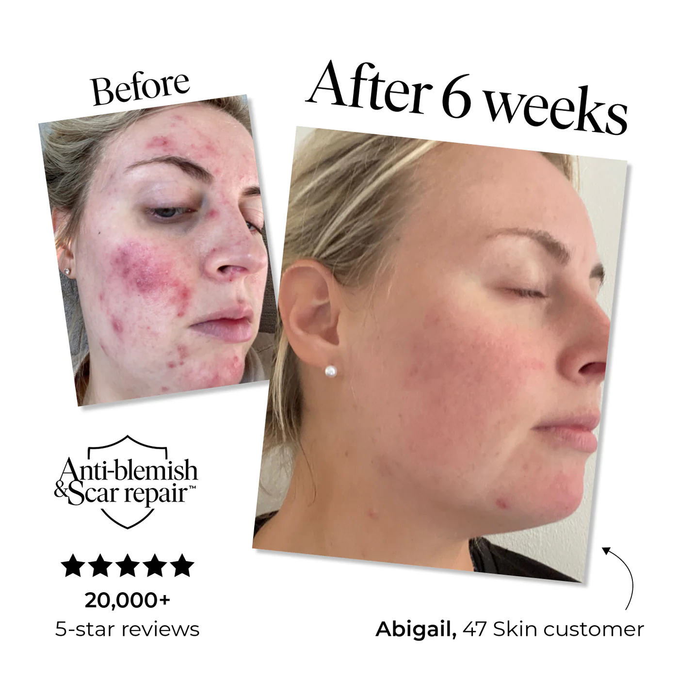The Miracle of Skin Regeneration